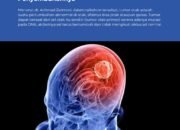 Pemkab Bojonegoro Ajak Warga Waspadai Tumor Otak Sejak Dini